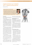 Vorschauseite 1: Folgekrankheiten durch Diabetes Teil 4 - Diabetische Neuropathie