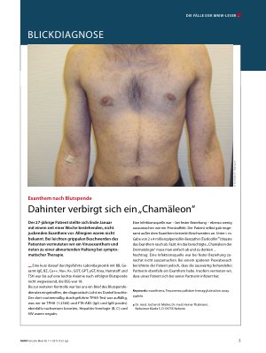 Vorschauseite 1: De