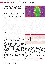 Vorschauseite 3: TACE - transarterielle Chemoembolisation der Leber
