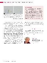 Vorschauseite 5: TACE - transarterielle Chemoembolisation der Leber
