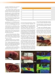 Vorschauseite 2: Falldarstellungen vom Einsatz der TIVITA® Tissue als Diagnostikverfahren in der Wundtherapie