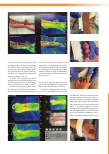 Vorschauseite 3: Falldarstellungen vom Einsatz der TIVITA® Tissue als Diagnostikverfahren in der Wundtherapie