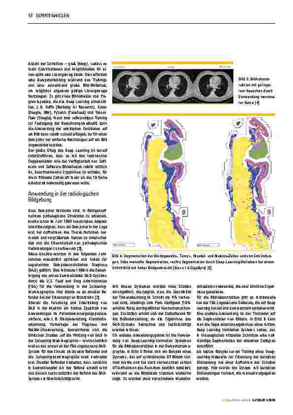 Vorschauseite 3: Computerassistierte Diagnosesysteme: Künstliche Intelligenz – die Zukunft der Radiologie?