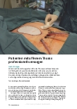 Vorschauseite 1: Patienten mit offenem Thorax professionell versorgen