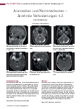 Vorschauseite 1: Anomalien und Normvarianten – Zerebrale Veränderungen 4.2 Arachnoidalzyste