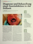 Vorschauseite 1: Diagnose und Behandlung einer Soorinfektion in der Stillzeit