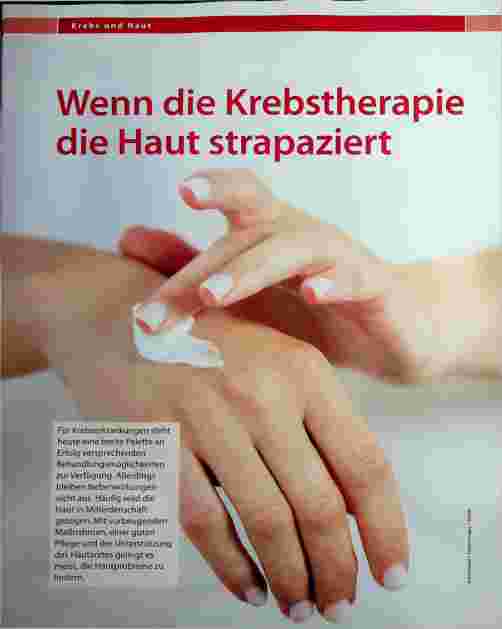 Vorschauseite 1: Wenn die Krebstherapie die Haut strapaziert