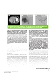 Vorschauseite 4: Interventionelle Onkologie Teil 1 – Grundlagen und transarterielle Chemoembolisation