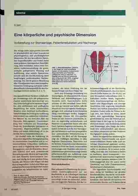 Vorschauseite 1: Eine körperliche und psychische Dimension Vorbereitung zur Stomaanlage, Patientenedukation und Nachsorge.