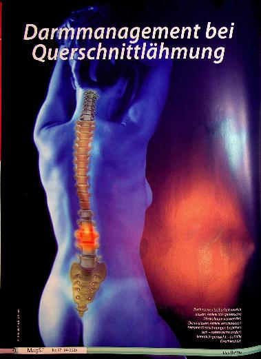 Vorschauseite 1: Darmmanagement bei Querschnittlähmung