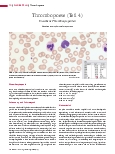 Vorschauseite 1: Thrombopoese (Teil 4) Erworbene Thrombozytopenien