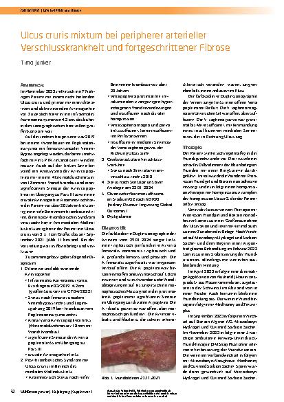 Vorschauseite 1: Ulcus cruris mixtum bei peripherer arterieller Verschlusskrankheit und fortgeschrittener Fibrose