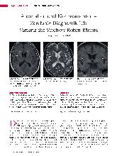 Vorschauseite 1: Anomalien und Normvarianten - Zerebrale Diagnostik 1.8: Varianz der Virchow-Robin-Räume