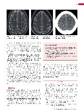 Vorschauseite 2: Anomalien und Normvarianten - Zerebrale Diagnostik 1.8: Varianz der Virchow-Robin-Räume