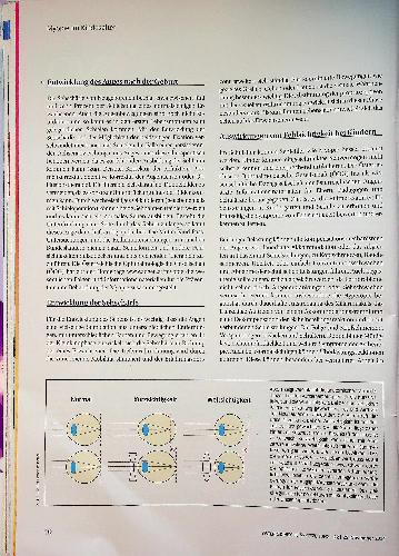 Vorschauseite 3: Myopie im Kindesalter