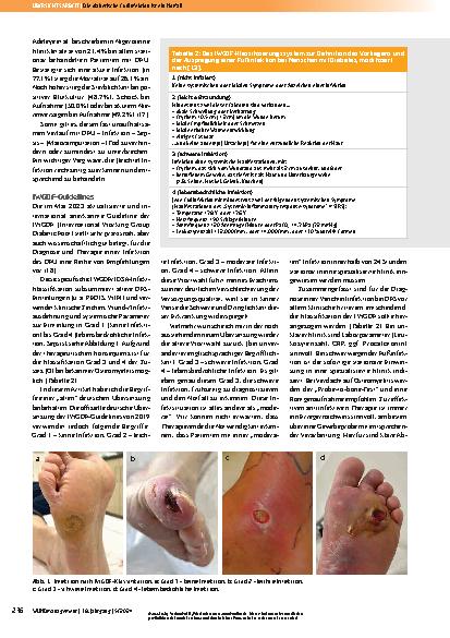Vorschauseite 3: Die diabetische Fußinfektion ist ein Notfall.