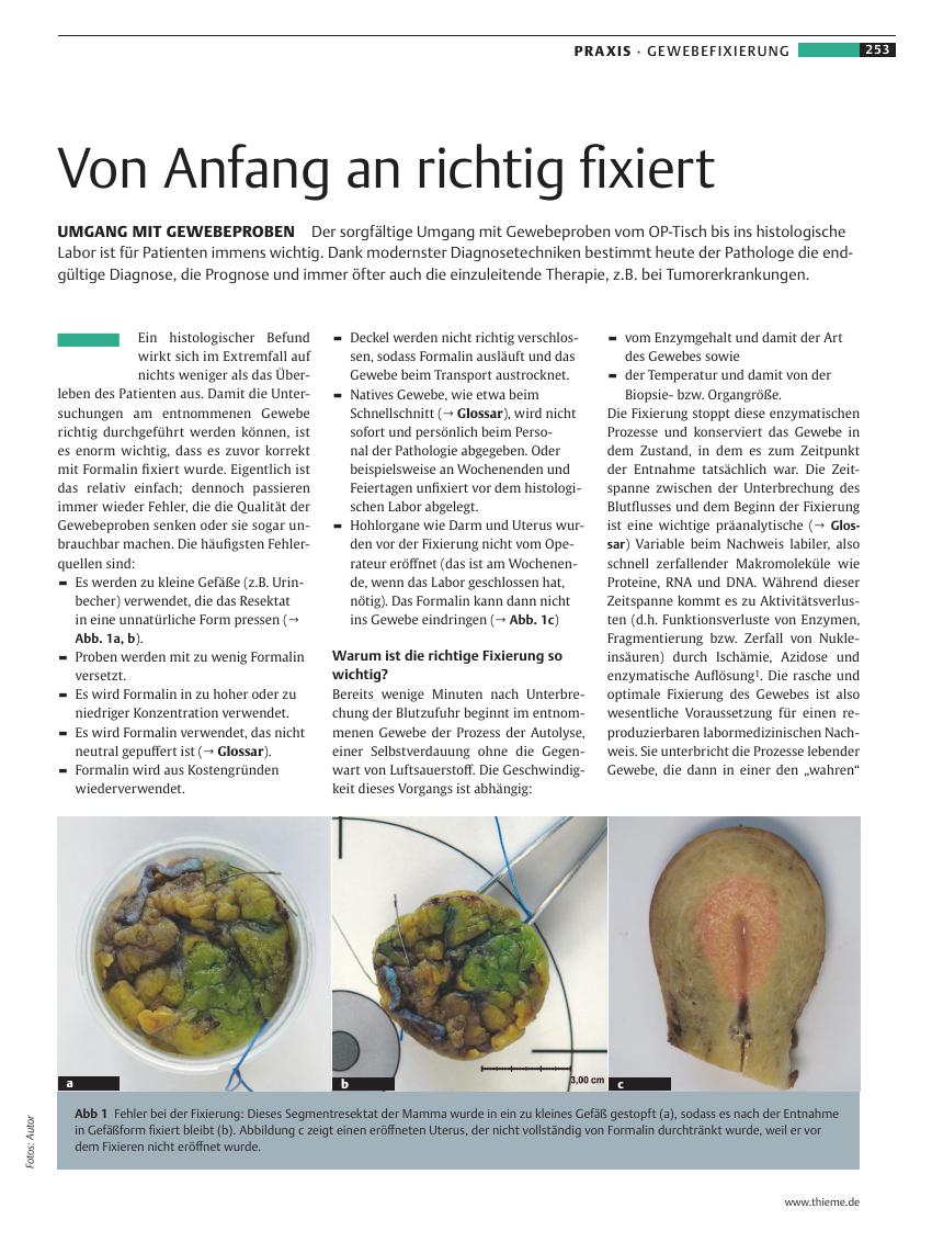 Vorschauseite 1: Von Anfang an richtig fixiert