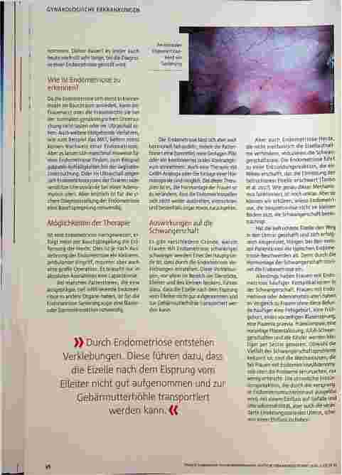 Vorschauseite 3: Endometriose: Verirrte Schleimhautzellen