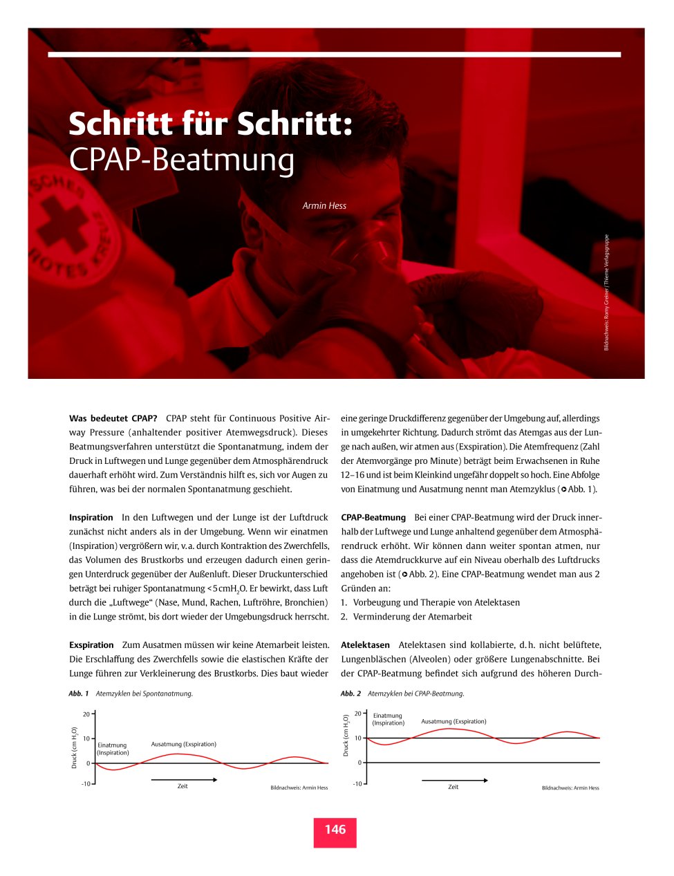 Vorschauseite 1: Schritt für Schritt: CPAP-Beatmung