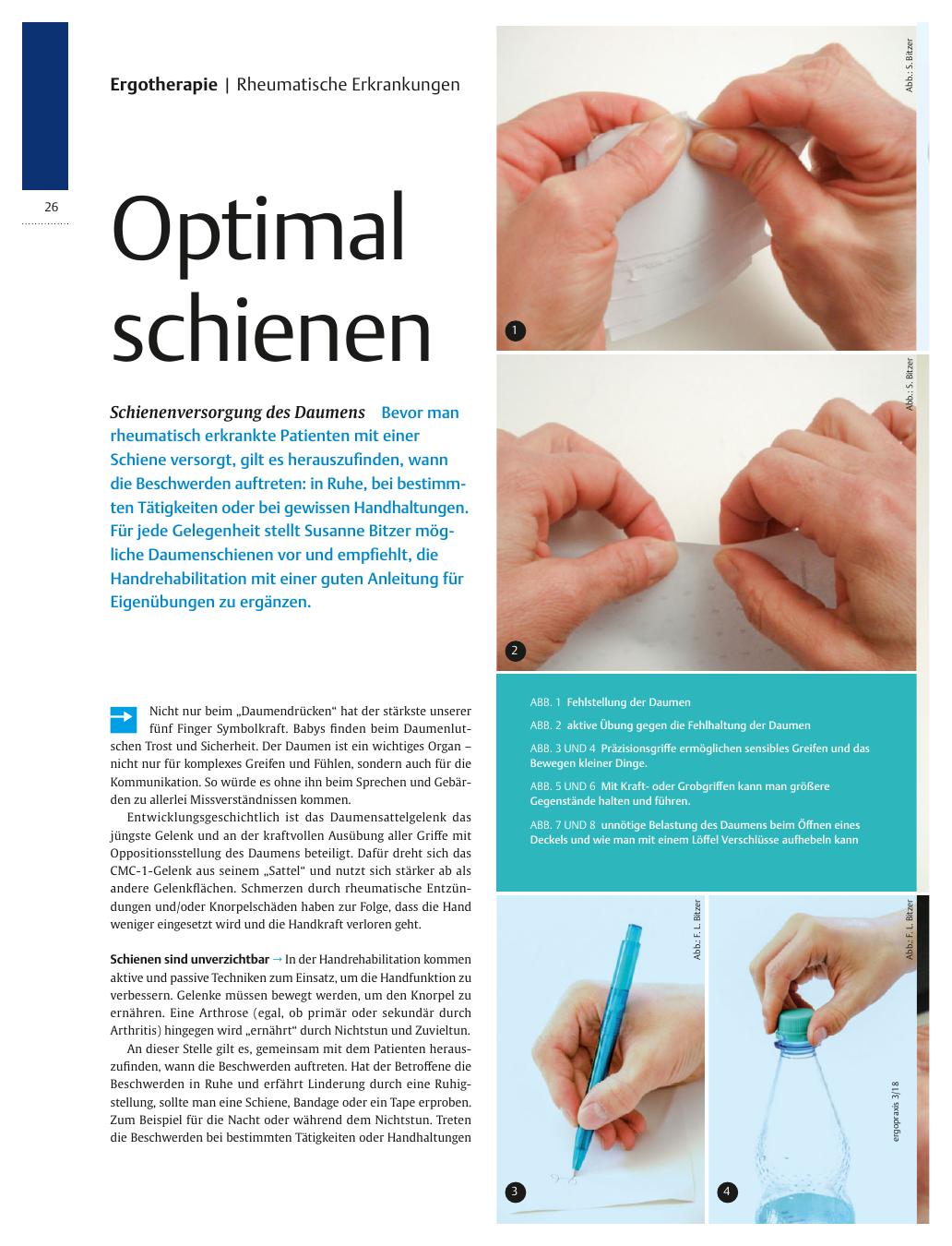 Vorschauseite 1: Schienenversorgung des Daumens ? Optimal schienen