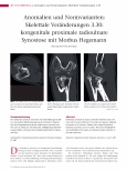 Vorschauseite 1: Anomalien und Normvarianten: Skelettale Veränderungen 3.30: kongenitale proximale radioulnare Synostose mit Morbus Hegemann