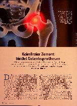 Vorschauseite 1: Keimfreier Zement bindet Gelenksprothesen