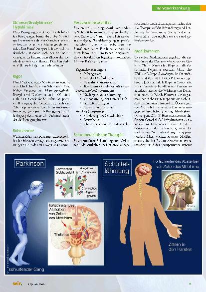 Vorschauseite 2: Dr. James Parkinson und die Schüttellähmung Ganzheitliche Sicht und Behandlung von Morbus Parkinson
