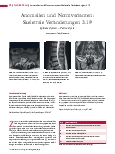 Vorschauseite 1: Anomalien und Normvarianten: Skelettale Veränderungen 3. 19 Spinale Zysten – Tarlov-Zyste