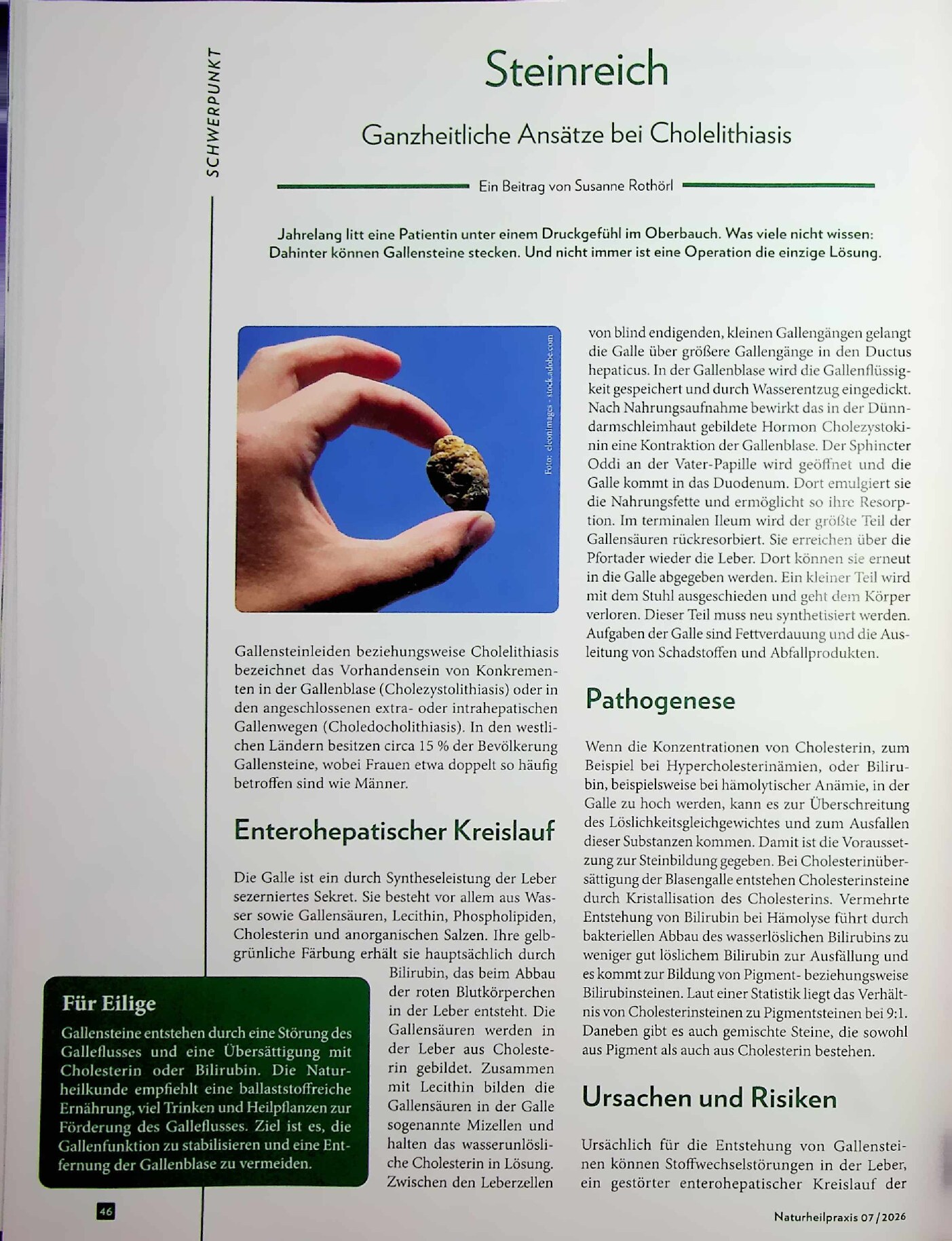 Vorschauseite 1: Steinreich. Ganzheitliche Ansätze bei Cholelithiasis
