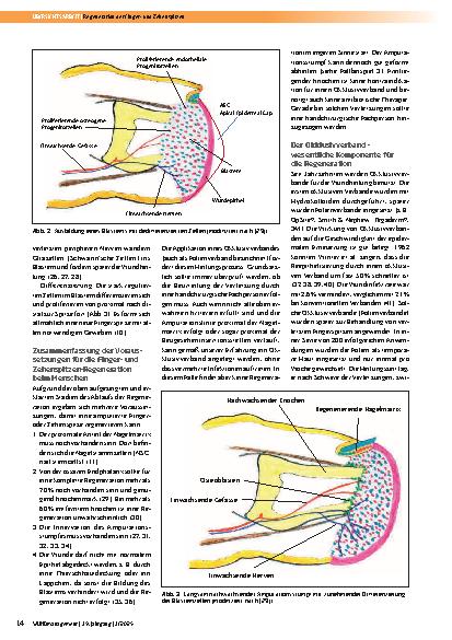 Vorschauseite 3: Regeneration der Fingerund Zehenspitzen nach Verletzungen