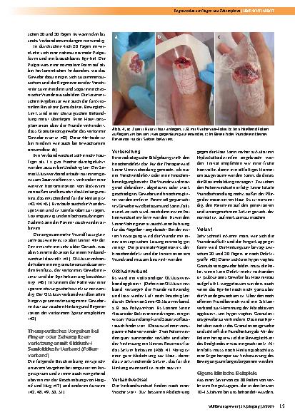 Vorschauseite 4: Regeneration der Fingerund Zehenspitzen nach Verletzungen