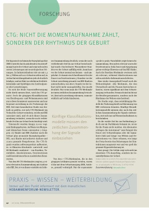 Vorschauseite 1: CTG; nicht die Momentaufnehme zählt, sondern der Rhythmus der Geburt