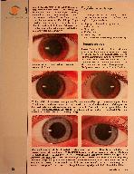 Vorschauseite 2: Miasmen im Auge Teil 4: Syphilinie