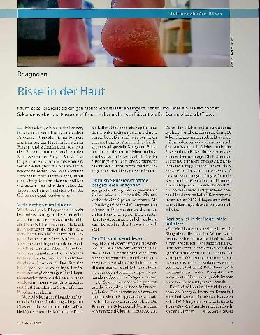 Vorschauseite 1: Rhagaden Risse in der Haut