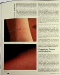 Vorschauseite 3: Moxibustion für ein starkes Immunsystem