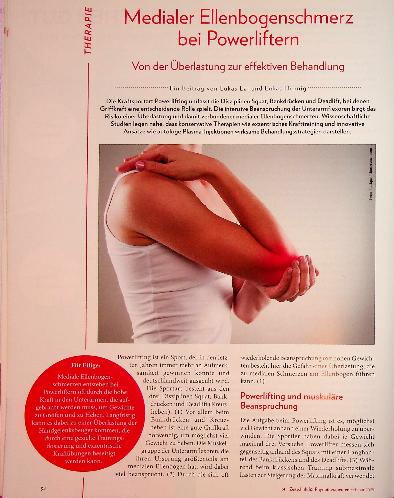 Vorschauseite 1: Medialer Ellenbogenschmerz bei Powerliftern Von der Überlastung zur effektiven Behandlung
