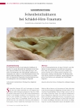 Vorschauseite 1: Felsenbeinfrakturen bei Schädel-Hirn-Traumata