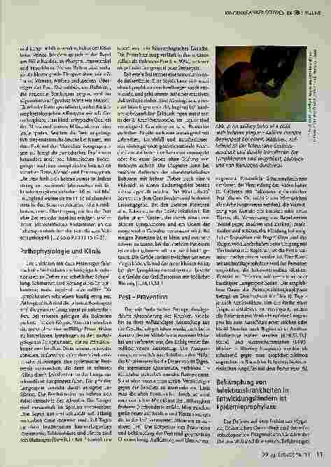 Vorschauseite 4: Die Pest gestern und heute - eine Infektionskrankheit der Armen?