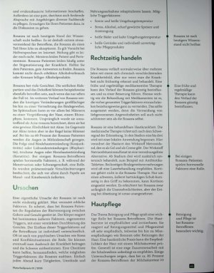 Vorschauseite 2: Der Fluch der Kelten Die Krankheit Rosazea