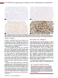 Vorschauseite 3: Optimierung und Validierung von PD-L1-Färbeprotokollen am Beispiel E1L3N (Teil 4)