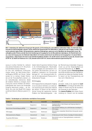 Vorschauseite 2: Synergistische Kombination physik-basierter und daten-getriebener Modelle KI zur nichtinvasiven Lokalisation kardialer Extrasystolen