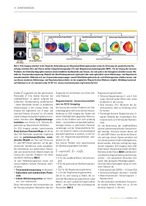 Vorschauseite 3: Synergistische Kombination physik-basierter und daten-getriebener Modelle KI zur nichtinvasiven Lokalisation kardialer Extrasystolen