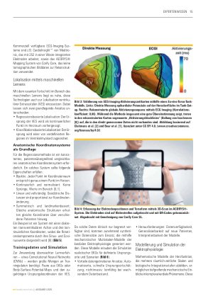 Vorschauseite 4: Synergistische Kombination physik-basierter und daten-getriebener Modelle KI zur nichtinvasiven Lokalisation kardialer Extrasystolen