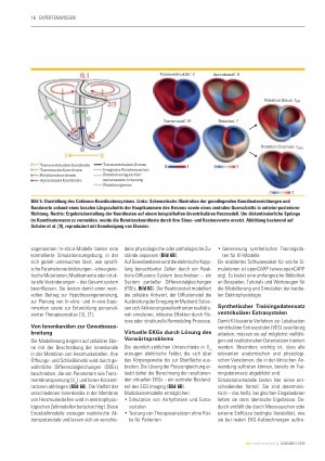 Vorschauseite 5: Synergistische Kombination physik-basierter und daten-getriebener Modelle KI zur nichtinvasiven Lokalisation kardialer Extrasystolen