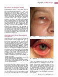 Vorschauseite 2: Allergologie (Teil 8) Krankheitsbilder (III)
