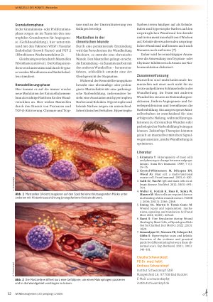 Vorschauseite 2: Mastzellen – Türöffner für Makrophagen und Neutrophile