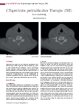 Vorschauseite 1: CT-gestützte periradikuläre Therapie (PRT) Kurz und bündig