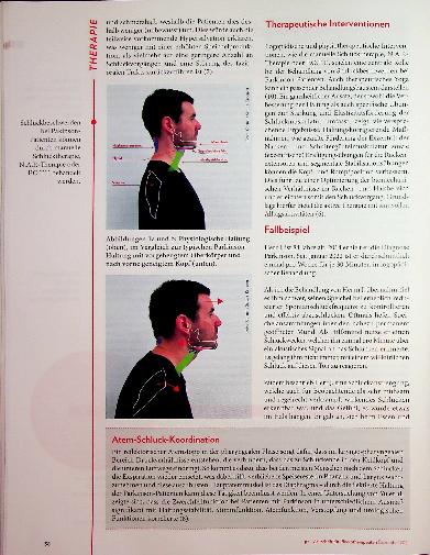 Vorschauseite 3: Haltung bewahren: Einflüsse auf die Biomechanik des Schluckens am Beispiel von M. Parkinson