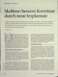 Vorschauseite 1: Skoliose: bessere Korrektur durch neue Implantate