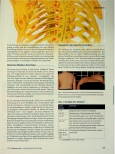 Vorschauseite 2: Skoliose: bessere Korrektur durch neue Implantate